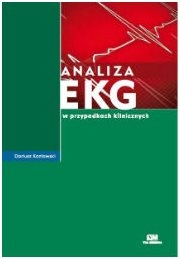 analiza ekg w przypadkach klinicznych 1